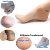 Anti crack heel( with box ) - Image 2